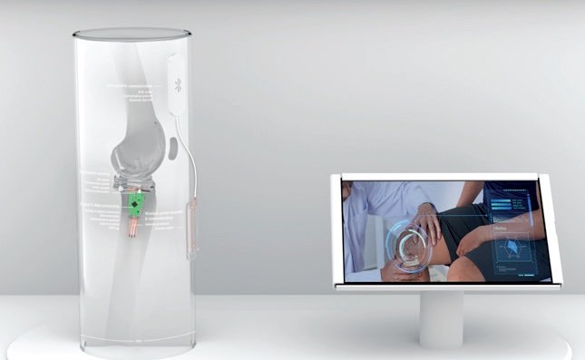 CEA-Leti to Unveil World’s-First Multi-Sensor System For Knee-Implants That Improves Surgery Accuracy, Detects Infection Early and Enhances Rehabilitation
